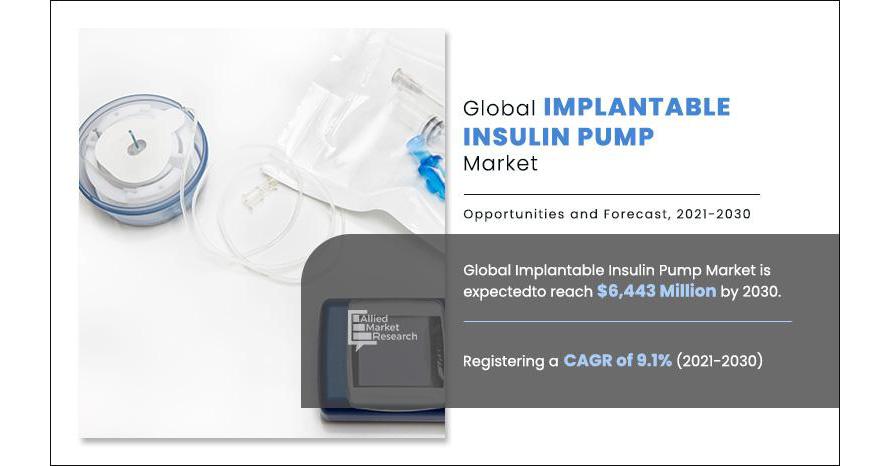 Implantable Insulin Pump Market Report Latest Trends And Future Opportunities Analysis 2024 2030 3935