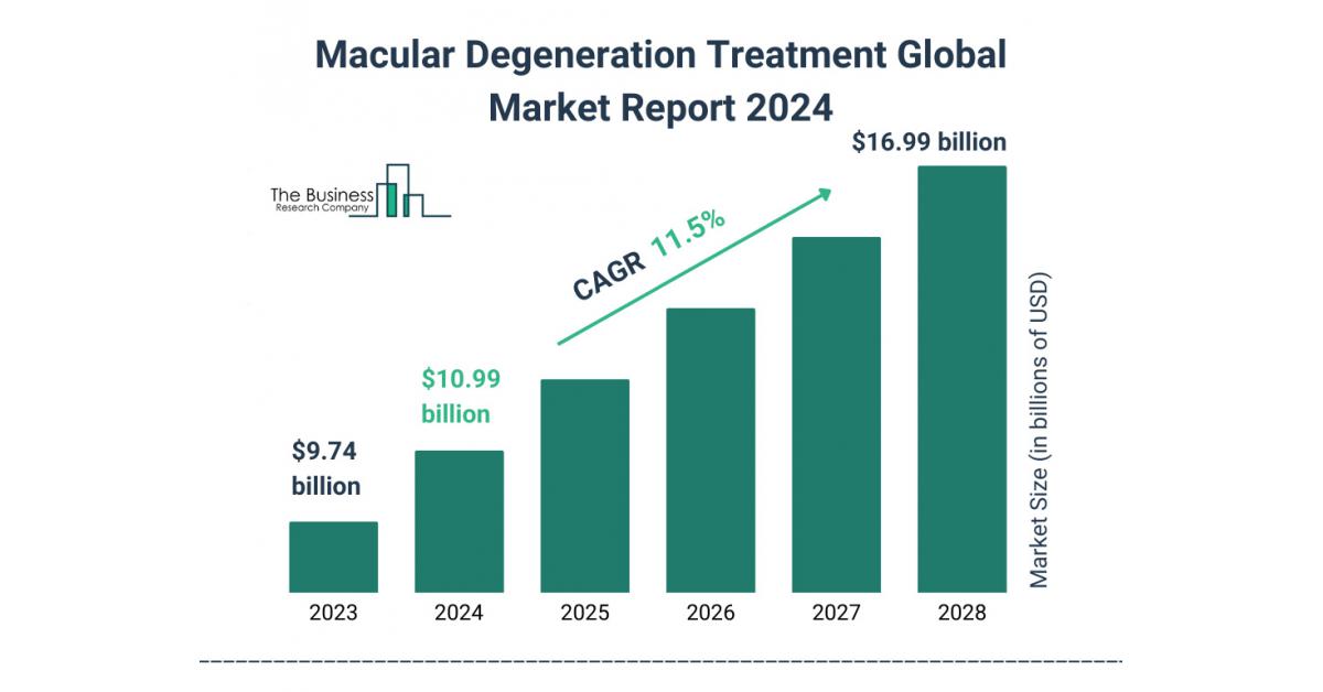 In-Depth Analysis Of The Global Macular Degeneration Treatment Market: Key Drivers, Trends And Growth Forecast 2024-2033