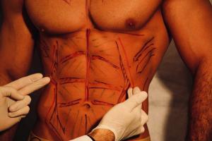 Haute Couture Body - Sixpack Surgery