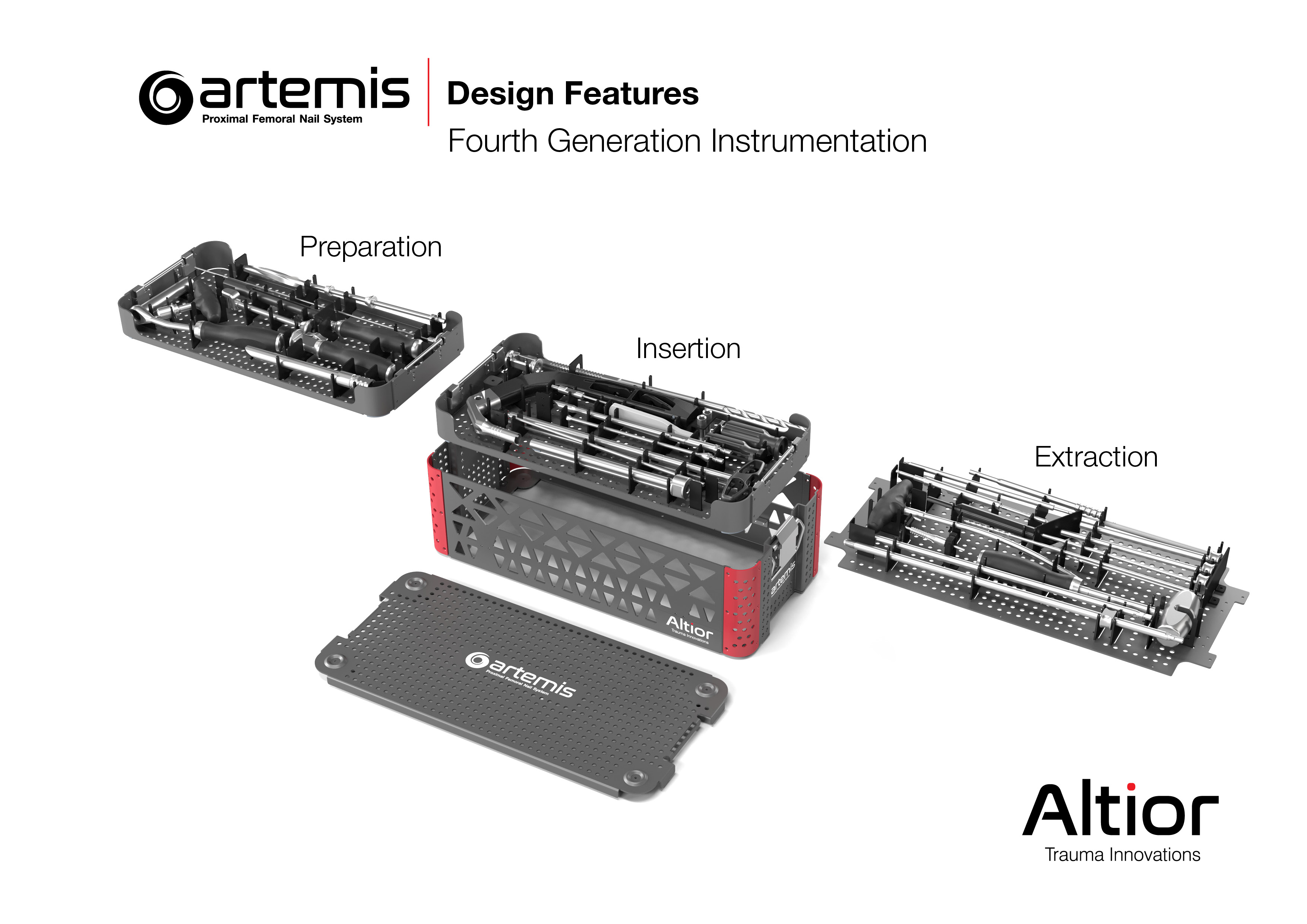 The Artemis System provides a fourth-generation nail with streamlined surgical instruments that allow for simplified implantation and superior patient benefits.  Among other unique design features, the instrument set includes a novel anti-rotation pin tha