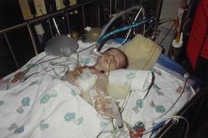 Shane Torrence was born with Congenital Diaphragmatic Hernia and did not have enough functioning lung to survive.
