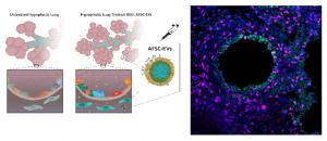 Exosomes from amniotic fluid stem cells in animal models and human lung cells to treat underdeveloped fetal lungs