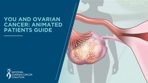 You and Ovarian Cancer is a highly visual ovarian cancer education tool that can be found at youandovariancancer.com