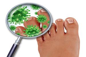 Antifungal Drugs Market