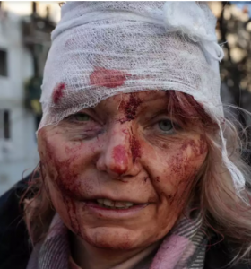 Oleno Kurilo, Ukrainian victim of Russian missile attack
