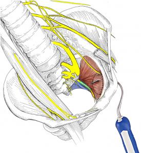 Obturator Internus Muscle