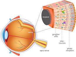 Artificial Retinal Implants Market