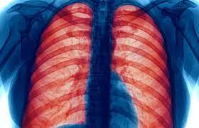 Chronic Obstructive Pulmonary Disorder (COPD) Market to Perceive Substantial Growth From 2022 to 2031