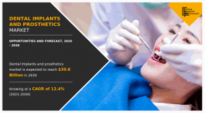 Dental Implants and Prosthetics Market Top Impacting Factors That Could Escalate Rapid Growth by 2030