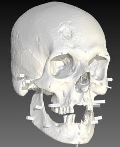 3D scan of JB55's skull with tissue depth markers helped guide the facial reconstruction.
