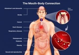 Salivary testing, OralDNA, Bristle, P-gingivalis, Mouth-Body Connection