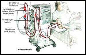 Kidney Dialysis Machine Market