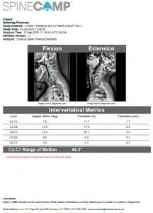 Sample SpineCAMP Report