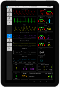 VitalStream hemodynamic monitoring data on tablet.