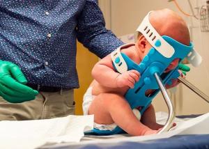 An infant is positioned in the SMöLTAP device, prepared to undergo a spinal tap.