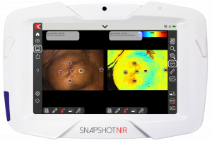 SnapshotNIR color image and tissue oxygen saturation image of a post-mastectomy breast reconstruction.