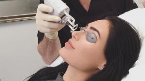 A woman is undergoing a Coolaser treatment at a cosmetic clinic. She is lying down with protective goggles on, while a practitioner in gloves carefully applies the Coolaser device to her face. The atmosphere is clinical and professional, with the patient