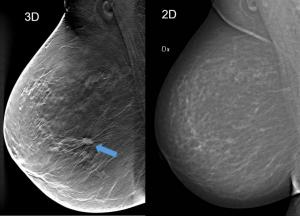 Breast Imaging