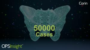 Corin Celebrates 50,000 OPS™ Cases