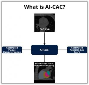 AI-CAC with calcium score, calcified plaque characterization, and cardiac chambers volumes.