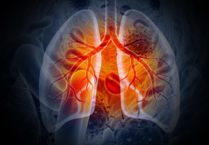 Global Lung Cancer Therapeutics Market