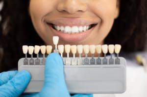 Dentist selecting the perfect enamel shade for a Black female patient during a porcelain veneer consultation in a clinic.