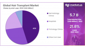 Hair Transplant Market Share