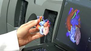 3D Print Medical Device Software