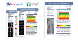 AutoBMD Patient Reports