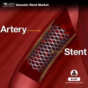 Vascular Stent Market