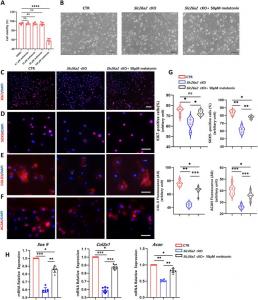 Melatonin promotes proliferation and expression of chondrocyte marker genes of Slc26a2-deficient chondrocytes.