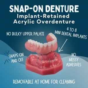 Snap-On Dentures in Kaysville, UT