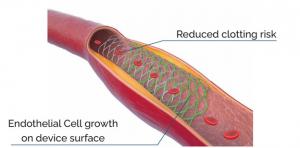 Smart Reactors - We offer transformative solutions to reduce thromboembolic complications and accelerate tissue healing.