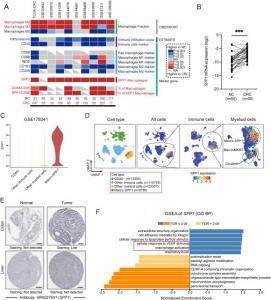 SPP1 is a novel macrophage marker in CRC.