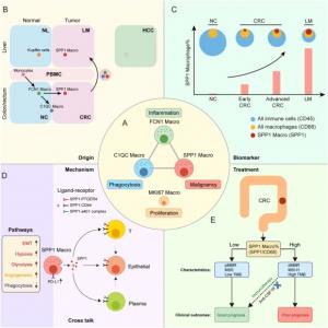 Schematic diagram of the SPP1+ macrophage model in CRC.