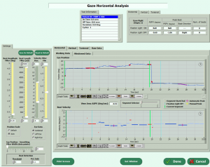 VEST™ operating and neurotologic analysis software screenshot.