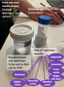 Two specimens created from a single core needle biopsy, following use of the Crow's Nest Biopsy Catchment System.  The first specimen, shown to the left, is a standard tissue core, to be sent to the pathology lab for FFPE.  The second specimen, shown to t