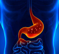 Erosive Esophagitis Market Epidemiology Report